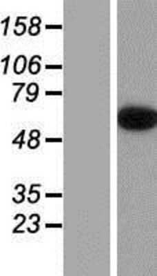 Western Blot: Epsin-2 Overexpression Lysate (Adult Normal) [NBP2-05424] Left-Empty vector transfected control cell lysate (HEK293 cell lysate); Right -Over-expression Lysate for Epsin-2.