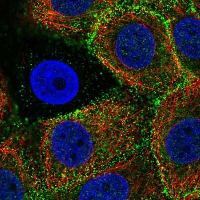Immunocytochemistry/ Immunofluorescence Epsin 3 Antibody - BSA Free