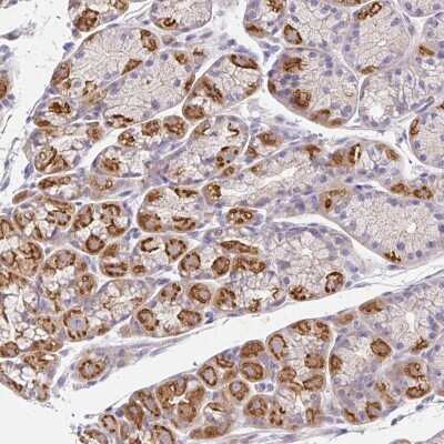 Immunohistochemistry-Paraffin: Epsin 3 Antibody [NBP2-49188] - Staining of human stomach, lower shows strong cytoplasmic positivity in glandular cells.