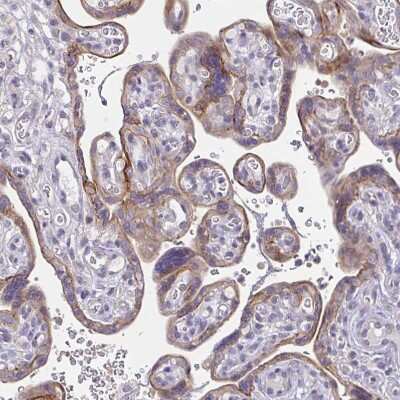 Immunohistochemistry-Paraffin: Epsin 3 Antibody [NBP2-49188] - Staining of human placenta shows strong cytoplasmic positivity in trophoblastic cells.