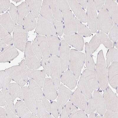 Immunohistochemistry-Paraffin: Epsin 3 Antibody [NBP2-49188] - Staining of human skeletal muscle shows no positivity in myocytes as expected.