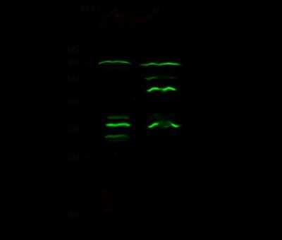 Western Blot: Epsin 3 Antibody [NBP2-98974] - Anti-Epsin 3 rabbit polyclonal antibody at 1:500 dilution. Lane A: MCF7 Whole Cell Lysate. Lane B: K562 Whole Cell Lysate. Lysates/proteins at 30 ug per lane. Secondary Goat Anti- Rabbit IgG H&L (Dylight 800) at 1/10000 dilution. Developed using the Odyssey technique. Performed under reducing conditions. Predicted band size: 68 kDa. Observed band size: 72 kDa (We are unsure as to the identity of these extra bands).