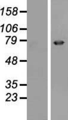 Western Blot Epsin 3 Overexpression Lysate