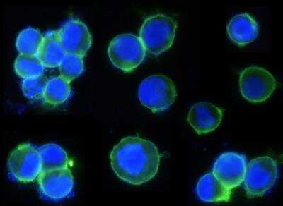 Immunocytochemistry/Immunofluorescence: ErbB2/Her2 Antibody (002) [NBP2-89184] - Staining of Human ErbB2 in SKBR3 cells. Cells were fixed with 4% PFA, blocked with 10% serum, and incubated with Rabbit anti-Human ErbB2 monoclonal antibody (1:100) at 4c overnight. Then cells were stained with the Alexa Fluor (R) 488-conjugated Goat Anti-rabbit IgG secondary antibody ( green ) and counterstained with DAPI ( blue ). Positive staining was localized to plasma membrane.