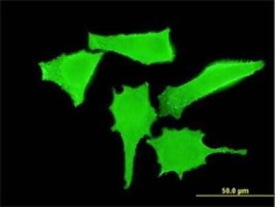 Immunocytochemistry/Immunofluorescence: ErbB2/Her2 Antibody (2D4) [H00002064-M02] - Analysis of monoclonal antibody to ERBB2 on HeLa cell . Antibody concentration 10 ug/ml.