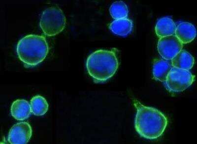 Immunocytochemistry/Immunofluorescence: ErbB2/Her2 Antibody (511) [NBP2-89187] - Staining of Human ErbB2 in SKBR3 cells. Cells were fixed with 4% PFA, blocked with 10% serum, and incubated with Rabbit anti-Human ErbB2 monoclonal antibody (1:100) at 4c overnight. Then cells were stained with the Alexa Fluor (R) 488-conjugated Goat Anti-rabbit IgG secondary antibody (green) and counterstained with DAPI (blue). Positive staining was localized to plasma membrane.