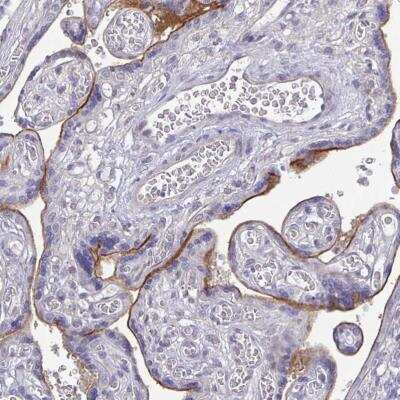 Immunohistochemistry-Paraffin: ErbB2/Her2 Antibody (CL0268) [NBP2-52896] - Staining of human placenta shows moderate membranous positivity in trophoblastic cells.