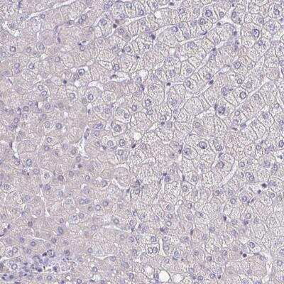 Immunohistochemistry-Paraffin: ErbB2/Her2 Antibody (CL0268) [NBP2-52896] - Staining of human liver shows no positivity in hepatocytes as expected.