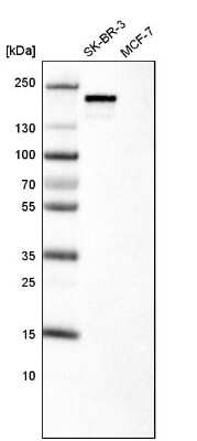 Western Blot: ErbB2/Her2 Antibody (CL0268) [NBP2-52896] - Analysis in human cell line SK-BR-3 and human cell line MCF-7.