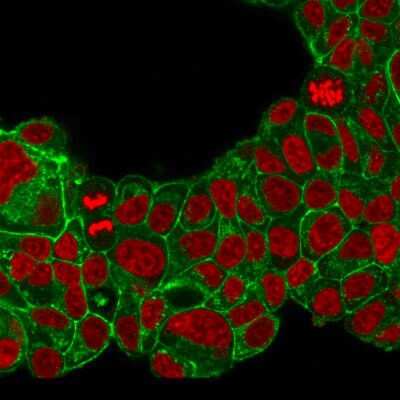 Immunocytochemistry/Immunofluorescence: ErbB2/Her2 Antibody (ERB2/776) - Azide and BSA Free [NBP2-48004] - Immunofluorescent staining of PFA-fixed MCF-7 cells with ErbB2/Her2 Mouse Monoclonal Antibody (HRB2/776) followed by goat anti-mouse IgG-CF488 (Green). Nuclei are stained with Reddot (Red).