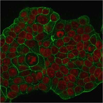 Immunocytochemistry/Immunofluorescence: ErbB2/Her2 Antibody (ERB2/776) [NBP2-44983] - ICC/IF staining of MCF-7 cells with  followed by goat anti-Mouse IgG-CF488 (Green). Nuclei are stained with Red Dot (Red).