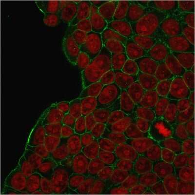 Immunocytochemistry/Immunofluorescence: ErbB2/Her2 Antibody (HRB2/273) [NBP2-44984] - ICC/IF staining of MCF-7 cells with  followed by goat anti-Mouse IgG-CF488 (Green). Nuclei are stained with Red Dot (Red).