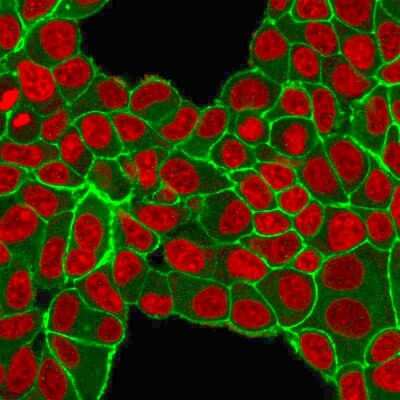 Immunocytochemistry/Immunofluorescence: ErbB2/Her2 Antibody (HRB2/451) - Azide and BSA Free [NBP2-33064] - Immunofluorescent staining of PFA-fixed MCF-7 cells with ErbB2/Her2 Monospecific Mouse Monoclonal Antibody (HRB2/451) followed by goat anti-Mouse IgG-CF488 (Green). Nuclei are stained with Reddot (Red).