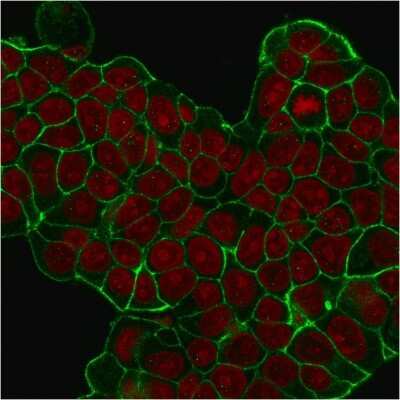 Immunocytochemistry/Immunofluorescence: ErbB2/Her2 Antibody (HRB2/451) [NBP2-29437] - ICC/IF staining of MCF-7 cells with  followed by goat anti-Mouse IgG-CF488 (Green). Nuclei are stained with Red Dot (Red).