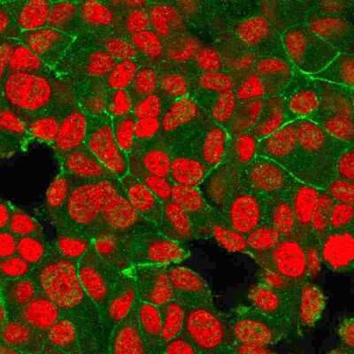 Immunocytochemistry/Immunofluorescence: ErbB2/Her2 Antibody (HRB2/718) [NBP2-32864] - Immunofluorescent staining of PFA-fixed MCF-7 cells with ErbB2/Her2 Monospecific Mouse Monoclonal Antibody (HRB2/718) followed by goat anti-Mouse IgG-CF488 (Green). Nuclei are stained with Reddot (Red).