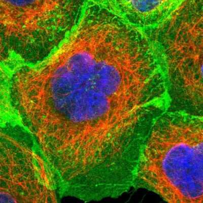 Immunocytochemistry/Immunofluorescence: ErbB2/Her2 Antibody [NBP2-55546] - Staining of human cell line A-431 shows localization to plasma membrane. Antibody staining is shown in green.