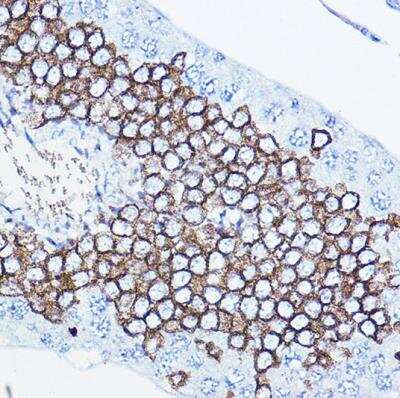 Immunohistochemistry-Paraffin: ErbB2/Her2 Antibody [NBP3-02960] - Rat testis using [KO Validated] HER2 / ErbB2 Rabbit pAb at dilution of 1:100 (40x lens).