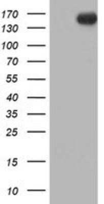 Western Blot: ErbB2/Her2 Antibody (OTI4F10) - Azide and BSA Free [NBP2-70653] - HEK293T cells were transfected with the pCMV6-ENTRY control (Left lane) or pCMV6-ENTRY ErbB2/HER2 (Right lane) cDNA for 48 hrs and lysed. Equivalent amounts of cell lysates (5 ug per lane) were separated by SDS-PAGE and immunoblotted with anti-ErbB2/HER2.