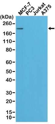 Western Blot: ErbB2/Her2 Antibody (RM228) [NBP2-61466] - Western Blot of MCF-7, PC3, Jurkat, and A375 cell lysates using NBP2-61466, showed a band of Her2 expressed only in MCF-7 cells.