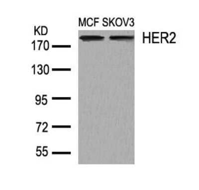 Western Blot: ErbB2/Her2 Antibody [NB100-81957] - Analysis of extracts from MCF and SKOV3 cells NB100-81957
