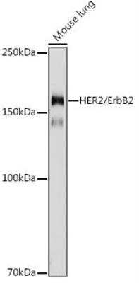 Western Blot: ErbB2/Her2 Antibody [NBP3-02960] - Analysis of extracts of Mouse lung, using HER2 / ErbB2 antibody at 1:500 dilution.Secondary antibody: HRP Goat Anti-Rabbit IgG (H+L) at 1:10000 dilution.Lysates/proteins: 25ug per lane. Blocking buffer: 3% nonfat dry milk in TBST.Detection: ECL Basic Kit. Exposure time: 180s.