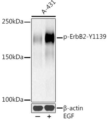 Western Blot: ErbB2/Her2 [p Tyr1139] Antibody (7N1S0) [NBP3-16960] - Western blot analysis of extracts of A-431 cells, using ErbB2/Her2 (NBP3-16960) at 1:500 dilution.A-431 cells were treated by EGF (100 ng/ml) at 37C for 30 minutes after serum-starvation overnight. Secondary antibody: HRP Goat Anti-Rabbit IgG (H+L) at 1:10000 dilution. Lysates/proteins: 25ug per lane. Blocking buffer: 3% nonfat dry milk in TBST. Detection: ECL Basic Kit. Exposure time: 90s.