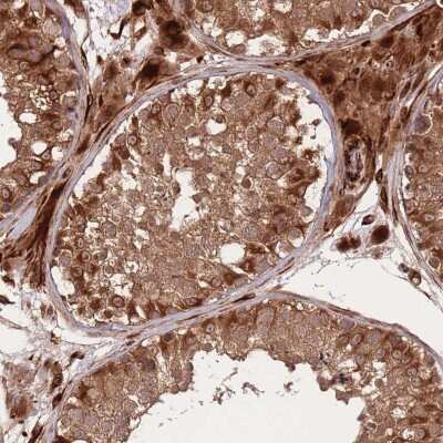 Immunohistochemistry: ErbB3/Her3 Antibody [NBP2-33289] - Staining of human testis shows strong cytoplasmic positivity in cells in seminiferus ducts and Leydig cells.