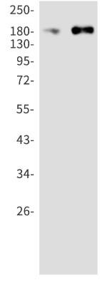 Western Blot: ErbB3/Her3 Antibody (S05-3F7) [NBP3-19862] - Western blot detection of ErbB3/Her3 in A549 (Lane 1), MCF-7 (Lane 2) cell lysates using NBP3-19862 (1:1000 diluted). Predicted band size: 148kDa. Observed band size: 185kDa.