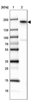 Western Blot: ErbB3/Her3 Antibody [NBP2-33289] - Lane 1: Marker  [kDa] 250, 130, 100, 70, 55, 35, 25, 15, 10.  Lane 2: SK-MEL-30