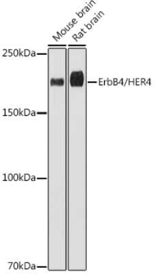 Western Blot: ErbB4/Her4 Antibody (8E5D0) [NBP3-15632] - Western blot analysis of extracts of various cell lines, using ErbB4/Her4 antibody (NBP3-15632) at 1:1000 dilution. Secondary antibody: HRP Goat Anti-Rabbit IgG (H+L) at 1:10000 dilution. Lysates/proteins: 25ug per lane. Blocking buffer: 3% nonfat dry milk in TBST. Detection: ECL Basic Kit. Exposure time: 180s.