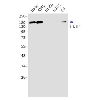 Western Blot: ErbB4/Her4 Antibody (S07-2H1) [NBP3-15027] - Western blot detection of ErbB4/Her4 in Hela, A549, HL-60, U2OS, C6 cell lysates using ErbB4/Her4 Rabbit mAb (1:1000 diluted). Predicted band size: 147kDa. Observed band size: 180kDa.