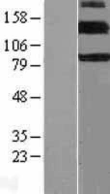 Western Blot: ErbB4 Overexpression Lysate (Adult Normal) [NBL1-10317] Left-Empty vector transfected control cell lysate (HEK293 cell lysate); Right -Over-expression Lysate for ErbB4.