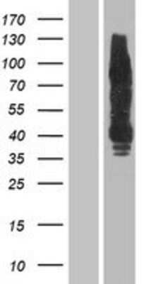 Western Blot: ErbB4 Overexpression Lysate (Adult Normal) [NBP2-04281] Left-Empty vector transfected control cell lysate (HEK293 cell lysate); Right -Over-expression Lysate for ErbB4.