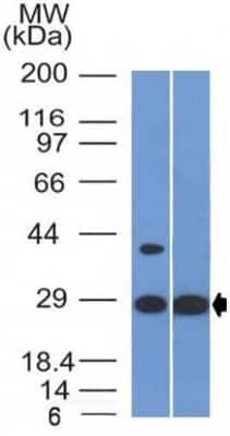 Western Blot: Erythropoietin/EPO Antibody (EPO/1368) [NBP2-53392] - Western Blot of human Heart and HepG2 cell lysate using Erythropoietin/EPO Antibody (EPO/1368).