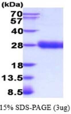 SDS-Page: Recombinant Human Erythropoietin Protein [NBP2-52209] - 15% SDS Page (3 ug)