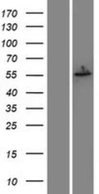 Western Blot: Estrogen Receptor beta Overexpression Lysate (Adult Normal) [NBP2-11196] Left-Empty vector transfected control cell lysate (HEK293 cell lysate); Right -Over-expression Lysate for Estrogen Receptor beta.