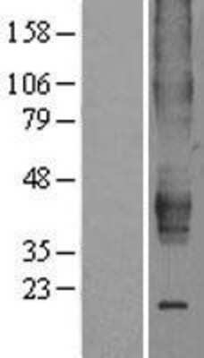 Western Blot: Estrogen Related Receptor beta Overexpression Lysate (Adult Normal) [NBP2-04272] Left-Empty vector transfected control cell lysate (HEK293 cell lysate); Right -Over-expression Lysate for Estrogen Related Receptor beta.