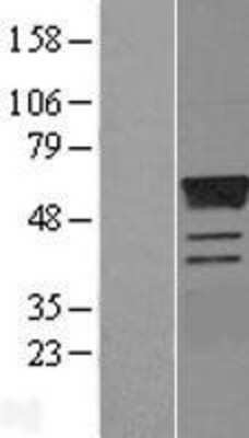 Western Blot: Estrogen Related Receptor gamma Overexpression Lysate (Adult Normal) [NBL1-10347] Left-Empty vector transfected control cell lysate (HEK293 cell lysate); Right -Over-expression Lysate for Estrogen Related Receptor gamma.