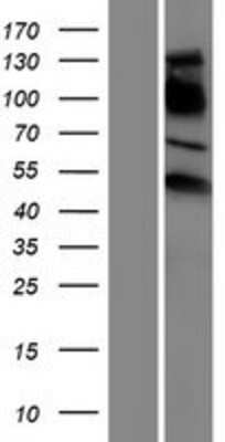 Western Blot: Estrogen Related Receptor gamma Overexpression Lysate (Adult Normal) [NBP2-04535] Left-Empty vector transfected control cell lysate (HEK293 cell lysate); Right -Over-expression Lysate for Estrogen Related Receptor gamma.