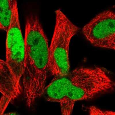 Immunocytochemistry/Immunofluorescence: Ets-1 Antibody [NBP2-56897] - Staining of human cell line RH-30 shows localization to nucleoplasm. Antibody staining is shown in green.