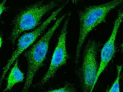 Immunocytochemistry/Immunofluorescence: Ets-1 Antibody [NBP2-98794] - Immunofluorescence staining of Ets-1 in HeLa cells. Cells were fixed with 4% PFA, blocked with 10% serum, and incubated with rabbit anti-human Ets-1 polyclonal antibody (1:1000) at 4C overnight. Then cells were stained with the Alexa Fluor(R)488-conjugated Goat Anti-rabbit IgG secondary antibody (green) and counterstained with DAPI (blue). Positive staining was localized to cytoplasm and nucleus.