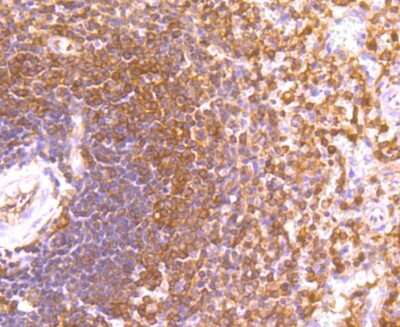 Immunohistochemistry-Paraffin: Ets-1 Antibody (JM92-32) [NBP2-66826] - Analysis of paraffin-embedded human spleen tissue using anti-ETS1 antibody. Counter stained with hematoxylin.