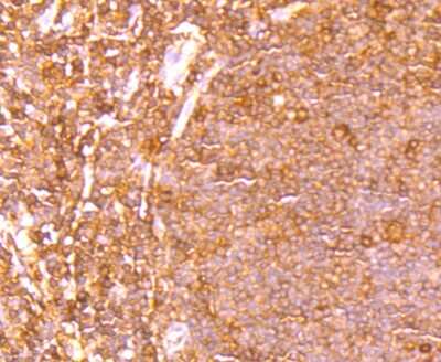 Immunohistochemistry-Paraffin: Ets-1 Antibody (JM92-32) [NBP2-66826] - Analysis of paraffin-embedded human tonsil tissue using anti-ETS1 antibody. Counter stained with hematoxylin.