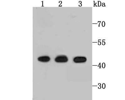 Western Blot: Ets-1 Antibody (JM92-32) [NBP2-66826] - Analysis of ETS1 on different cell lysates using anti-ETS1 antibody at 1/1,000 dilution. Positive control: Line1: Jurkat Line2: K562 Line3: HepG2
