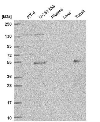 Western Blot: Ets-1 Antibody [NBP2-56897] - Analysis in human cell line RT-4, human cell line U-251 MG, human plasma, human liver tissue and human tonsil tissue.