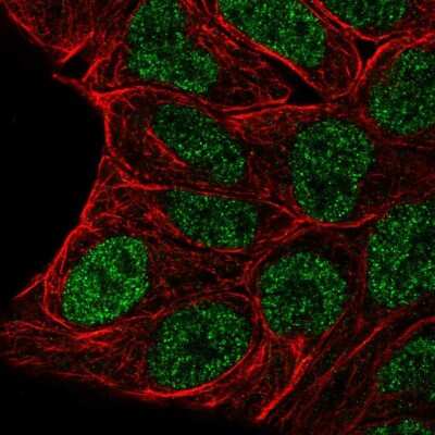 Immunocytochemistry/ Immunofluorescence Evx1 Antibody