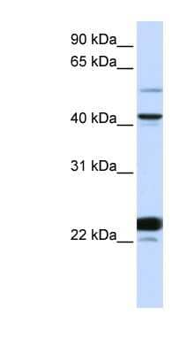 Western Blot: Evx1 Antibody [NBP1-79701] - Titration: 0.2-1 ug/ml, Positive Control: Hela cell lysate.