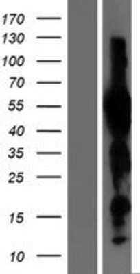 Western Blot Evx1 Overexpression Lysate