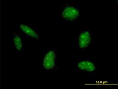 Immunocytochemistry/Immunofluorescence: Exonuclease 1 Antibody [H00009156-B01P-50ug] - Purified MaxPab antibody to EXO1 on HeLa cell. [antibody concentration 10 ug/ml]