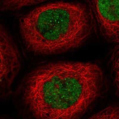 Immunocytochemistry/Immunofluorescence: Exonuclease 1 Antibody [NBP2-58299] - Staining of human cell line A-431 shows localization to nucleoplasm & nuclear bodies. Antibody staining is shown in green.